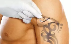 Как удалить (вывести) татуировку? Несколько способов.