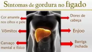8 principais sintomas de gordura no fígado