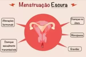 Menstruação na gravidez: principais causas e o que fazer