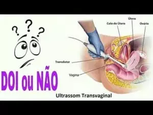 Ultrassom transvaginal: o que é, para que serve e quando fazer