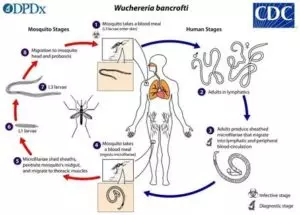 Sintomas de <i>Wuchereria bancrofti</i>, ciclo de vida e tratamento