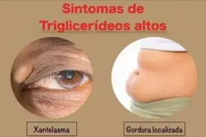 Sinais e sintomas de triglicerídeos altos