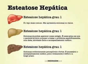 Esteatose hepática: o que é, sintomas, graus e tratamento
